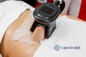 Does Fat Freezing At Home Work? 3 Fat freezing at home from Lipo Sculpt Oakham